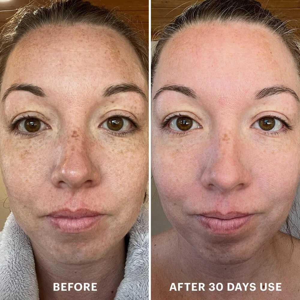glo Skin Beauty Bio-Renew EGF Cream GSB8753 178