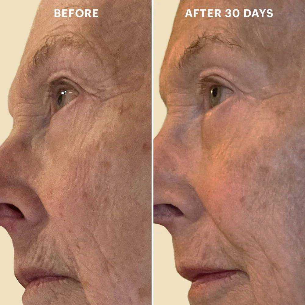 glo Skin Beauty Bio-Renew EGF Eye Cream GSB0909 108