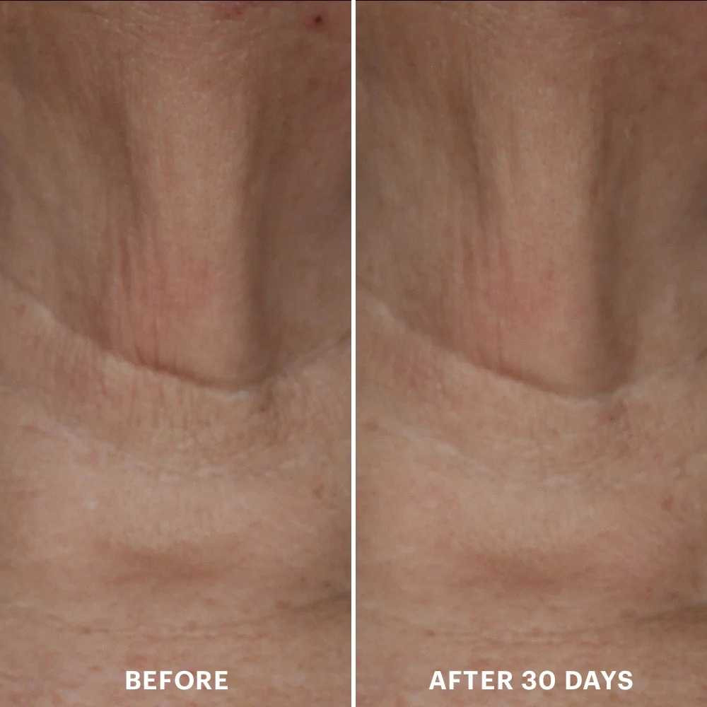 glo Skin Beauty Bio-Renew EGF Neck Cream GSB1555 118