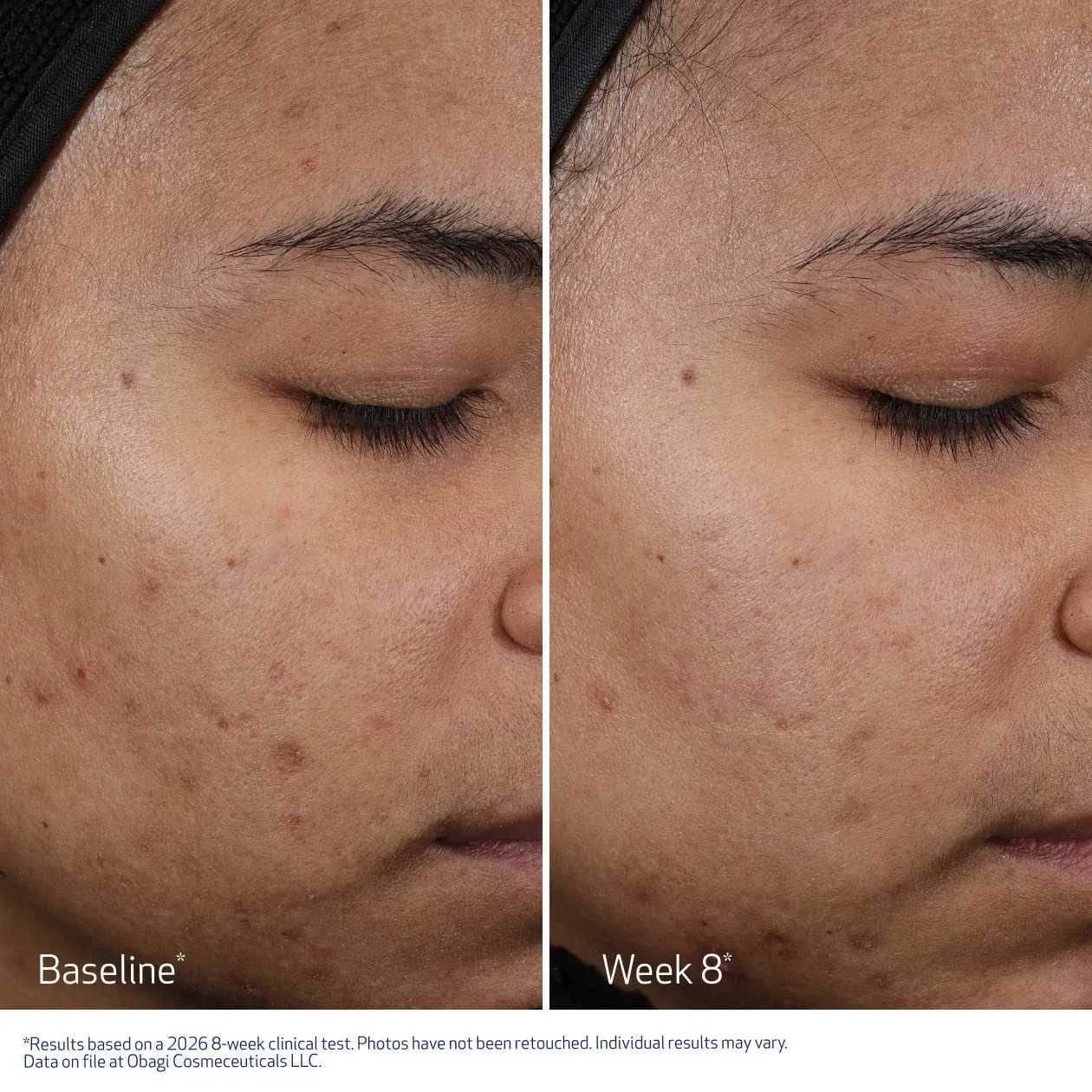 Obagi CLENZIDERM M.D. Resurfacing Multi-Acid Peel Pads OB-CMDR 100