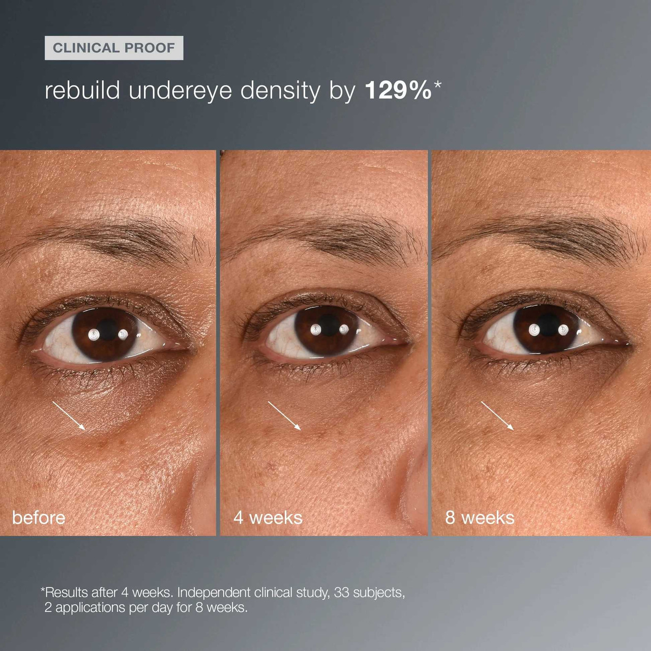 Dermalogica Smart Eye Density Undereye Serum DM111525 128