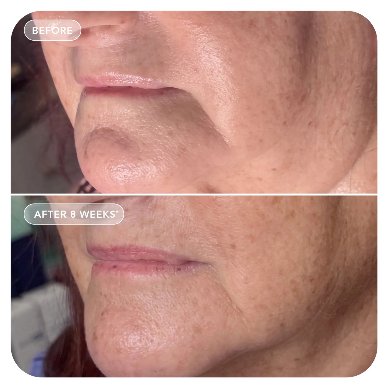IMAGE Skincare VOL.U.LIFT™ GLP-1 4D Skin Rebound Complex