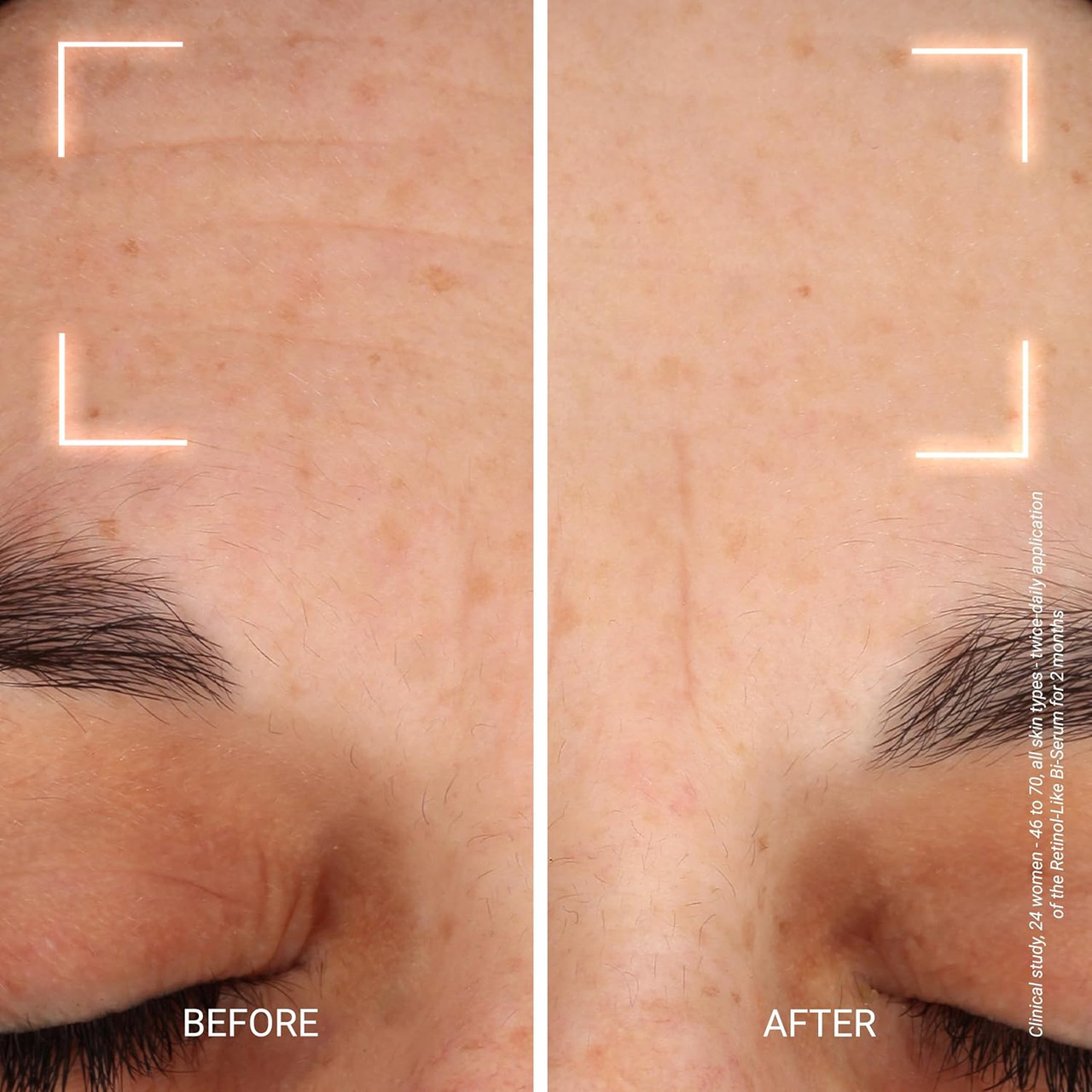 Yonka Bi-Serum Retinol-Like