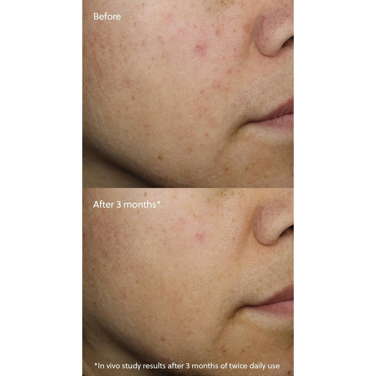 Eminence Vitamin C⁺ Serum E335 148