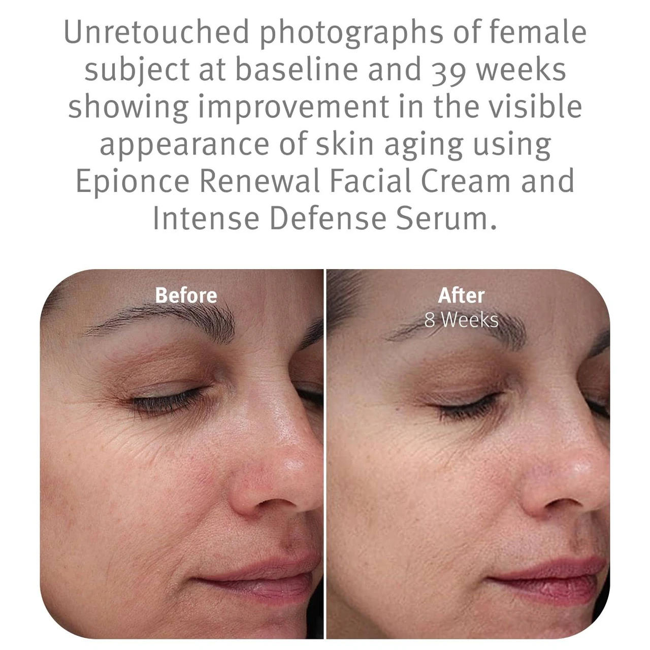 epionce Renewal Facial Cream before and after face photos