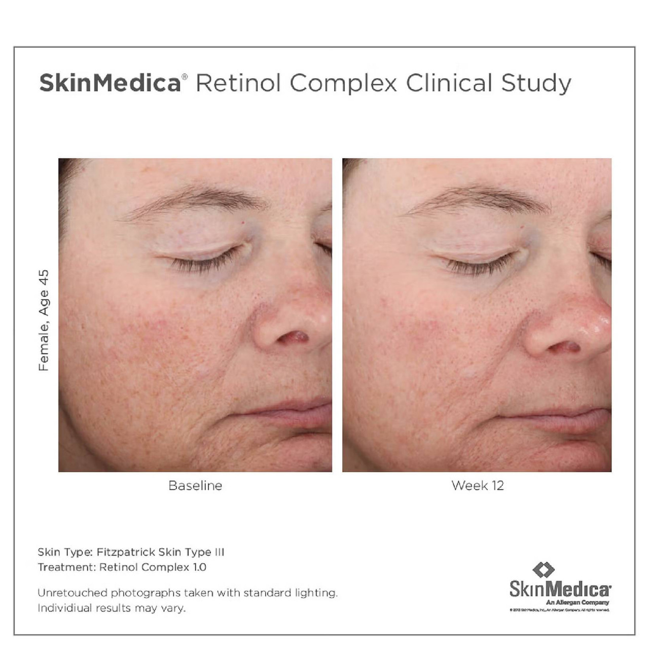 SkinMedica Retinol Complex