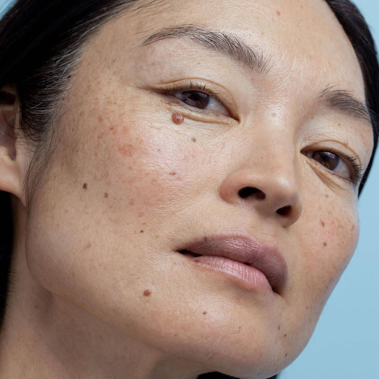 Obagi Nu-Derm Exfoderm Forte