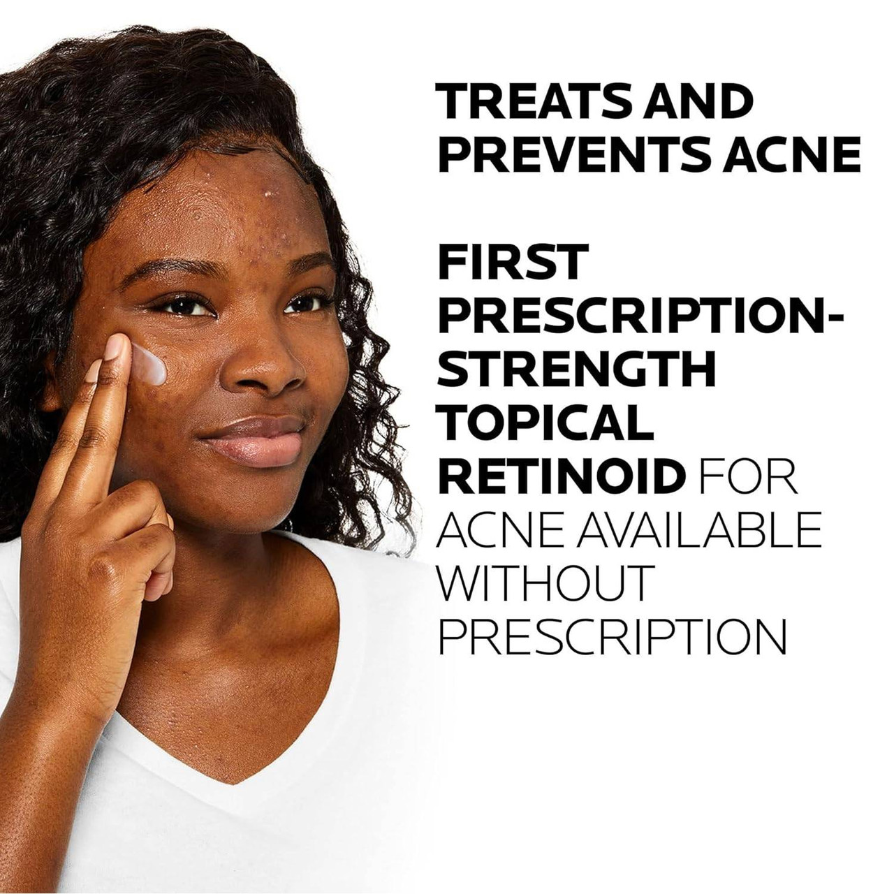 Model applying La Roche-Posay Effaclar Adapalene Gel to cheek with text overlay