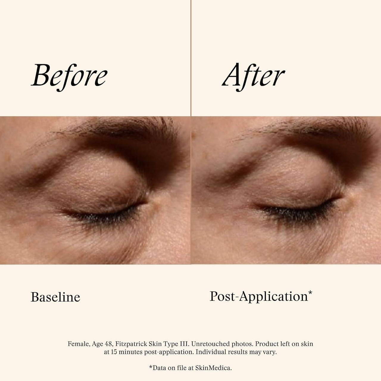 SkinMedica Instant Bright Eye Cream