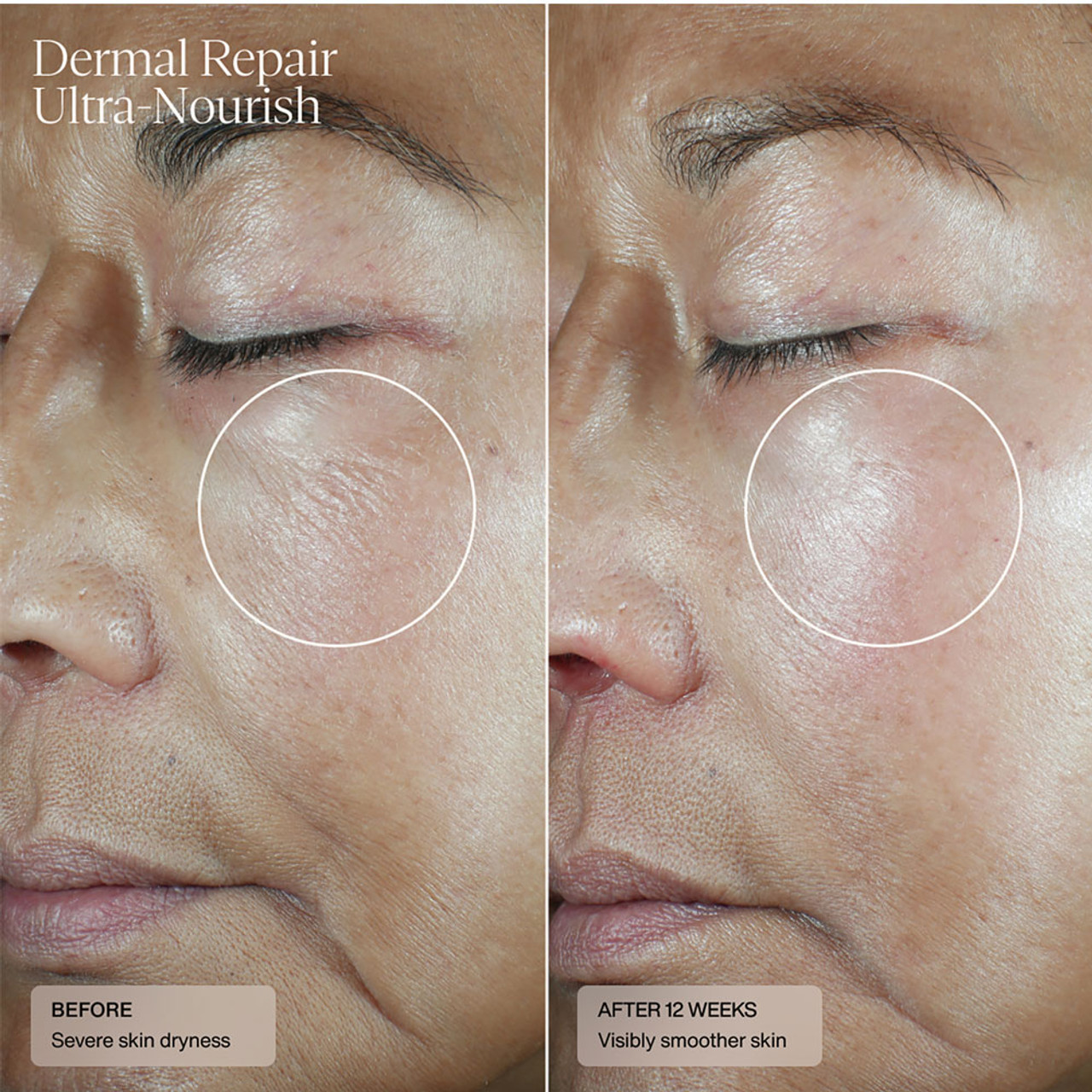 Sente Dermal Repair Ultra-Nourish BeautifiedYou.com BeautifiedYou.com