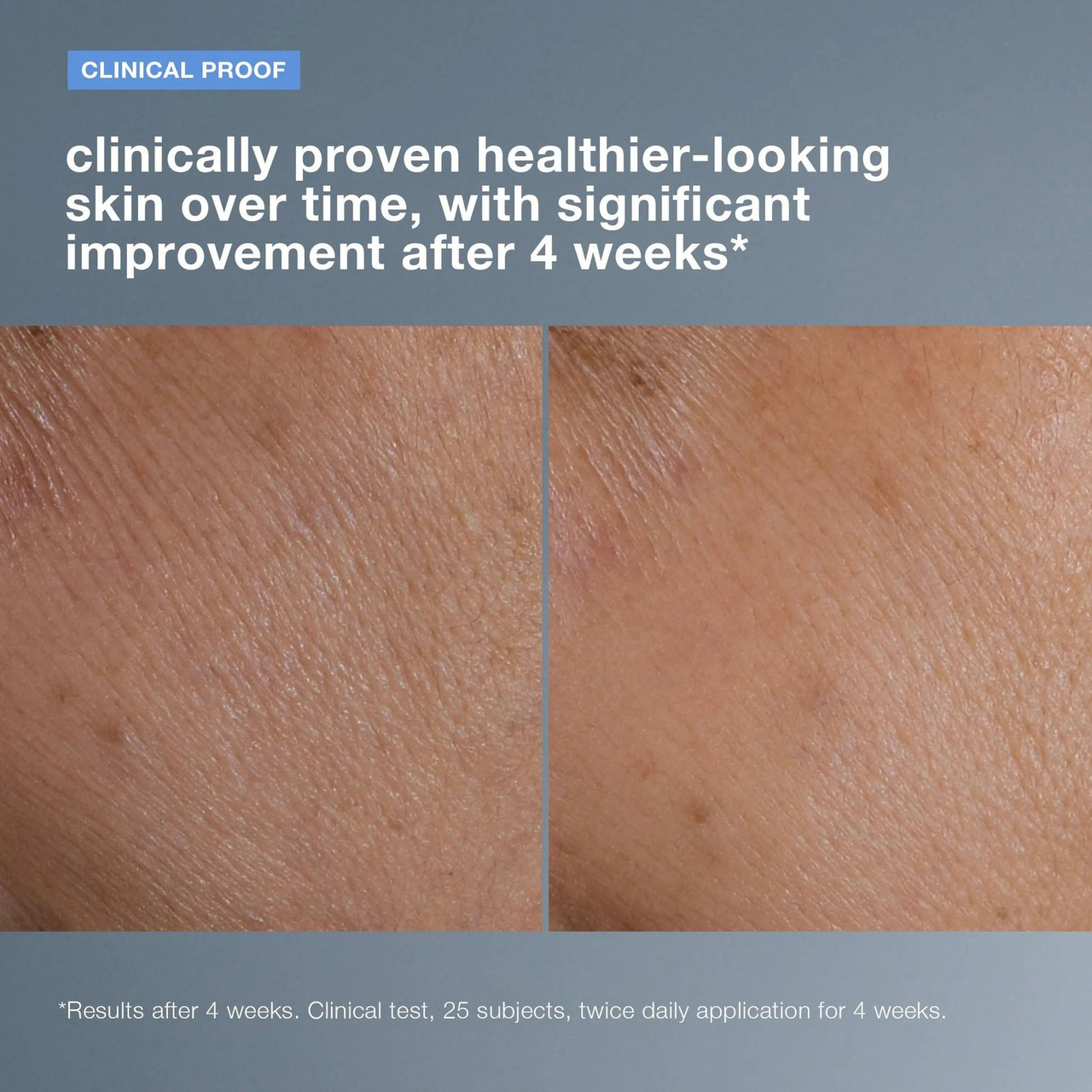 Skin before and after 4 weeks, clinical proof of healthier-looking skin