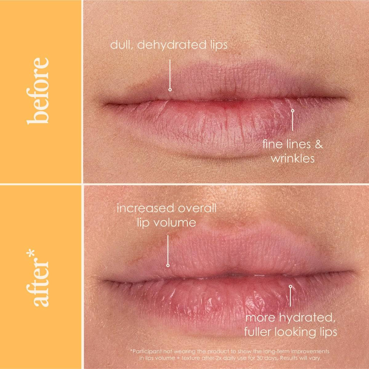 Before and after lips showing smoother, glossier look