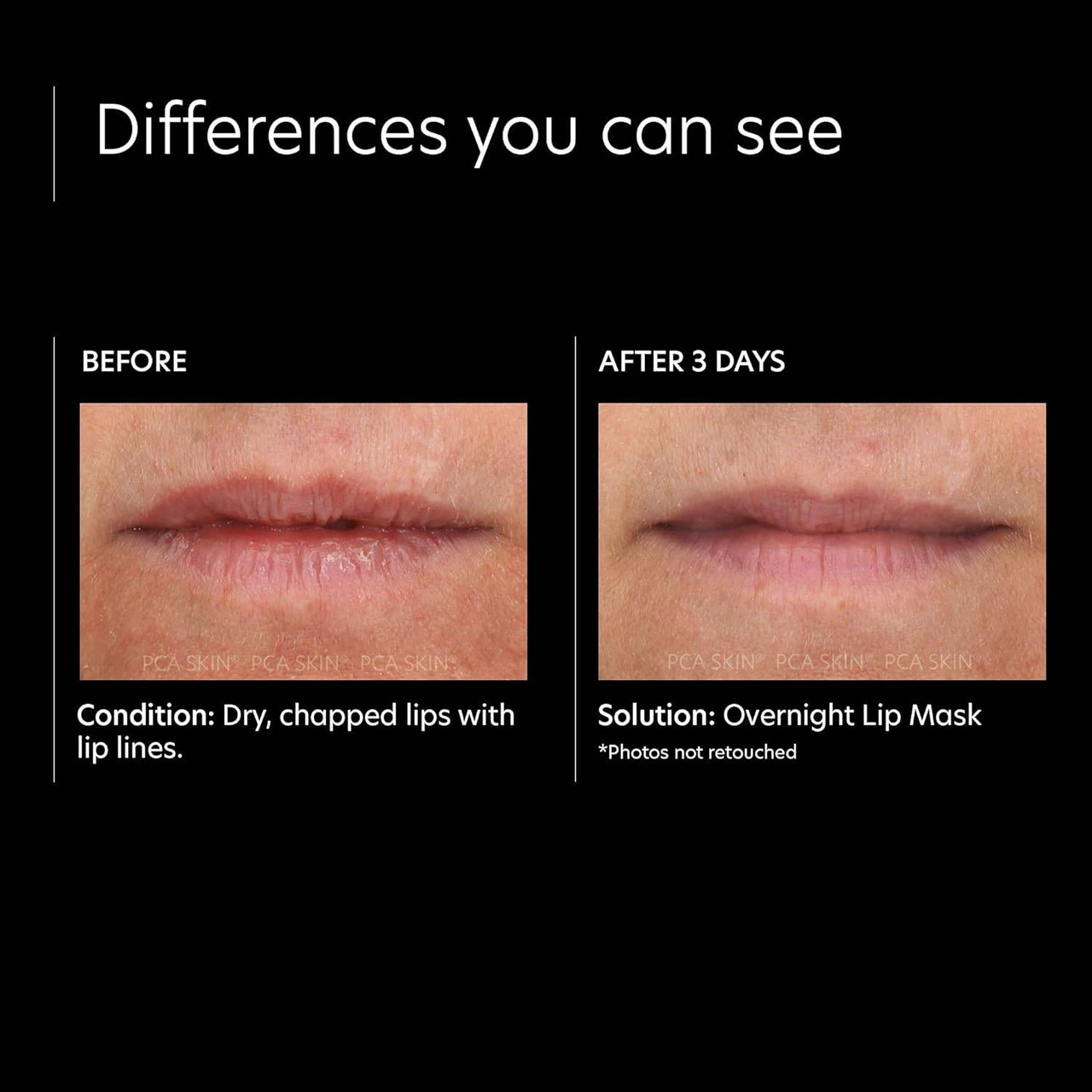 Before and after 3 days photos of dry lips