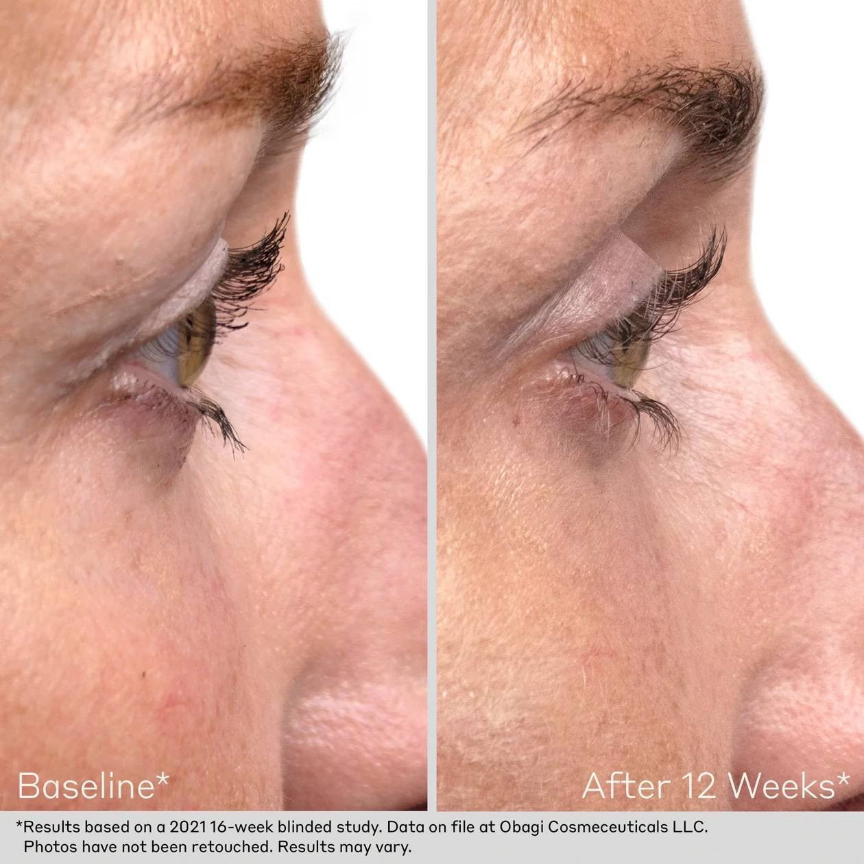 Obagi Nu-Cil Eyelash Enhancing Serum