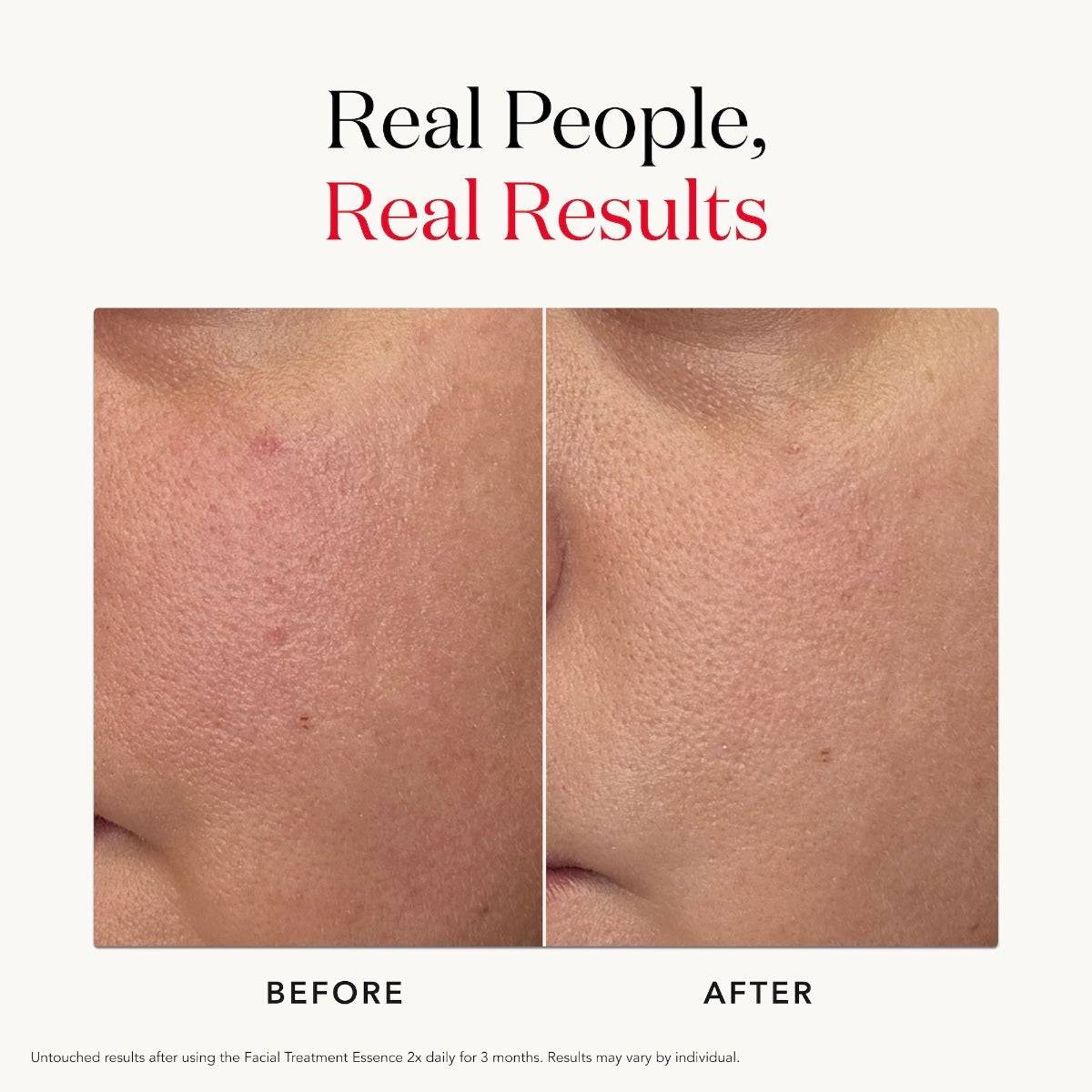 SK-II PITERA Facial Treatment Essence