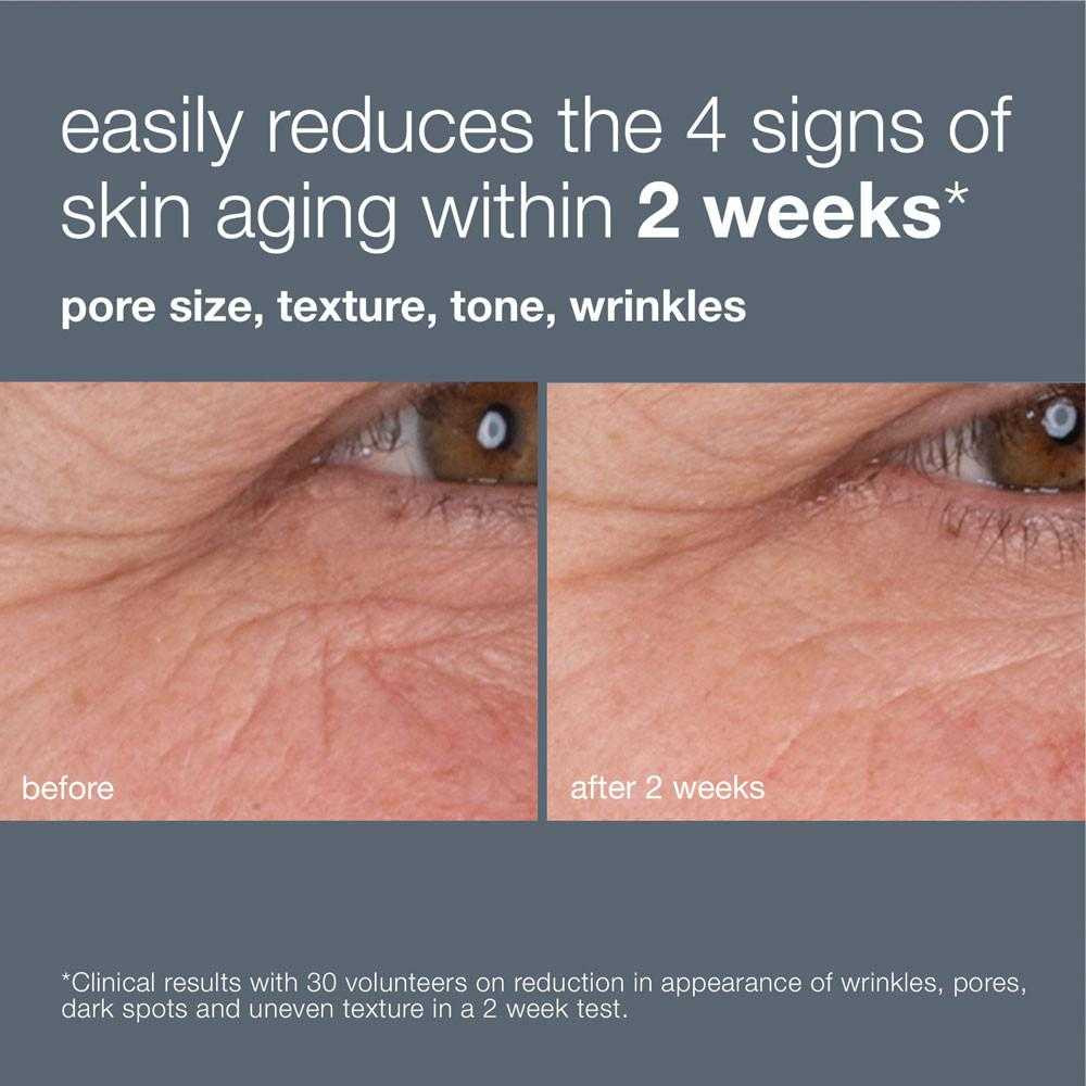 Before and after 2 weeks close-up of eye area wrinkles with Dynamic Skin Retinol Serum