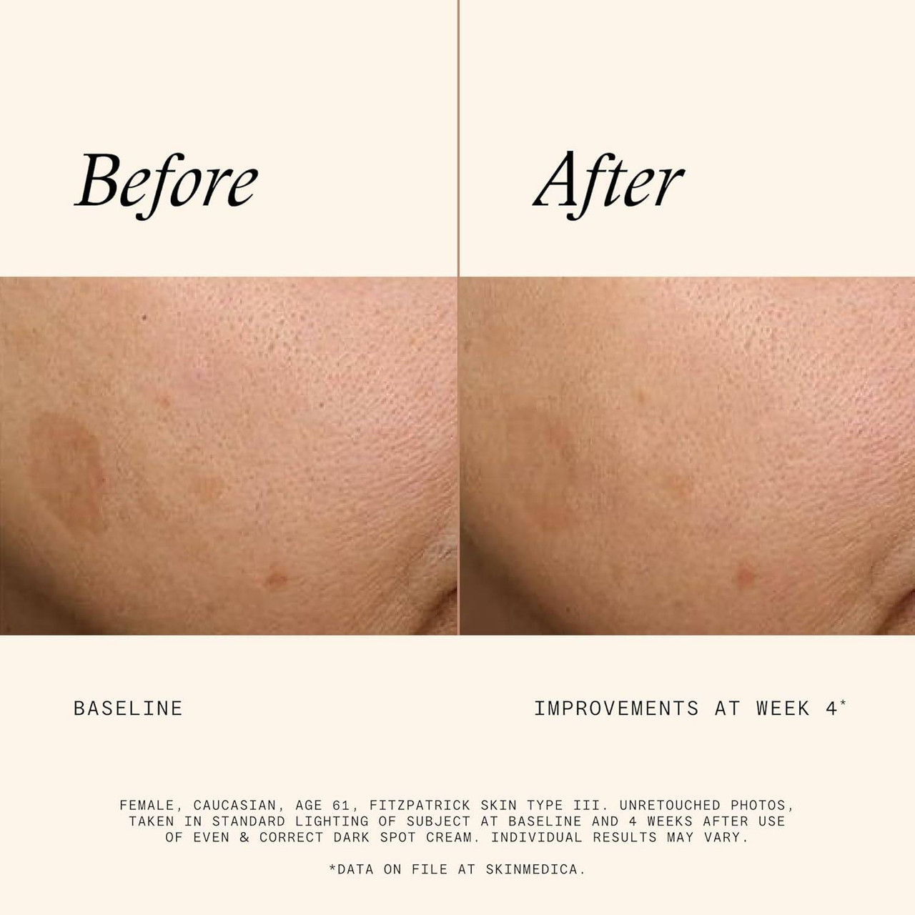 SkinMedica Even and Correct Dark Spot Cream