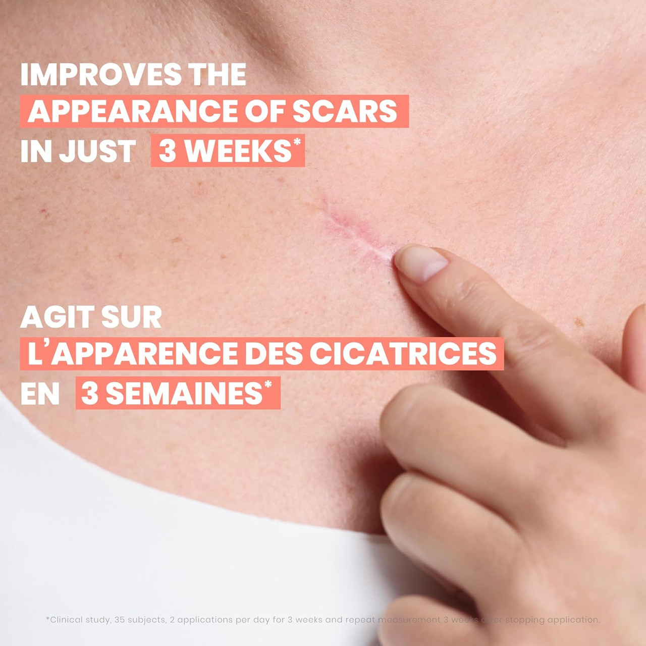 Avene Cicalfate+ Remodeling Scar Gel