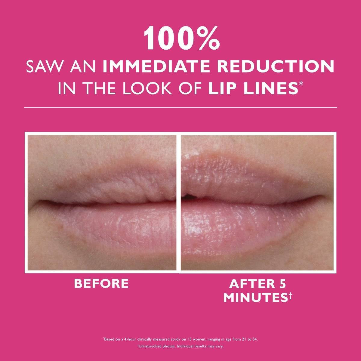Peter Thomas Roth Instant FirmX Lip Filler