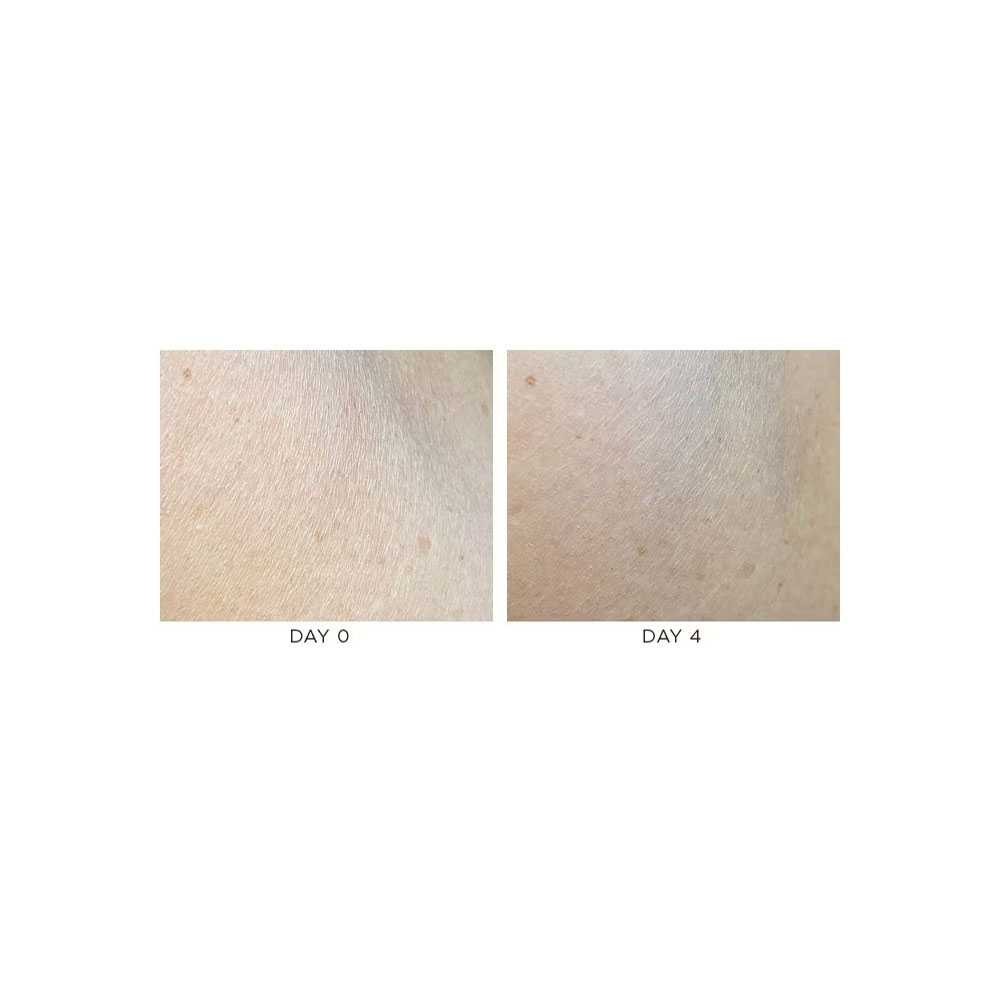 Skin texture photos, day 0 and day 4