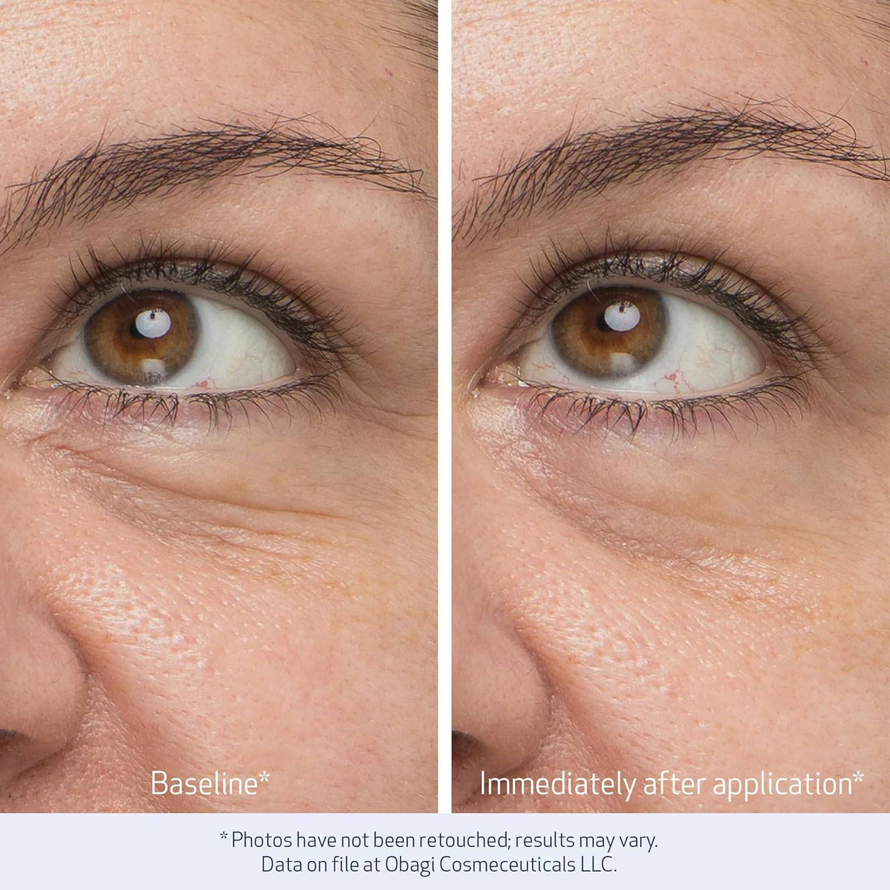 Obagi Daily Hydro-Drops Rejuvenating Eye Gel Cream