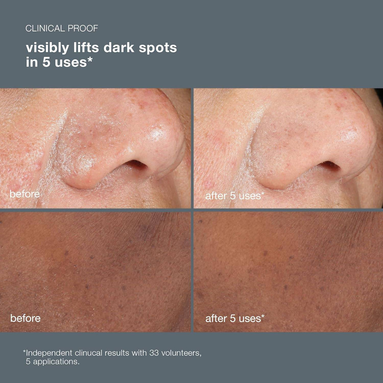 Dermalogica PowerBright Dark Spot Peel