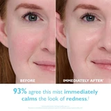 Before and immediately after photos of a woman's cheek, cooling mist results graphic