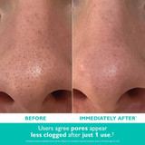 Nose before and immediately after use, pores appear less clogged