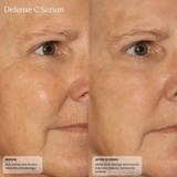 Before and after close-up of the eye area after 12 weeks