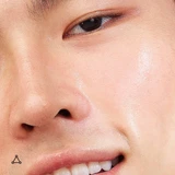 Close-up of a smiling model's smooth, glowing cheek