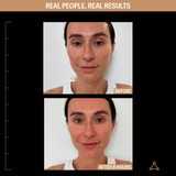 Before and after 8 hours on a second model, real people real results