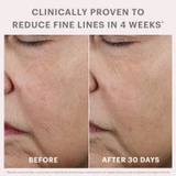 Before and after 30 days photos of fine lines around the eye
