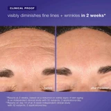 Forehead before and after 2 weeks, visibly diminishes fine lines clinical proof