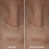 Close-up neck skin before and after 30 days