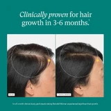Before and after scalp photos from a clinical study