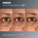 Undereye photos at baseline, 4 weeks and 6 weeks