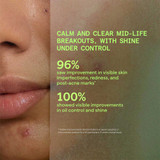 Murad Biome-Balancing Calm + Recover Cream M-BBCR 45
