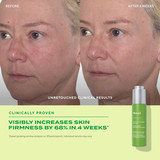 Oil Drops face before and after 4 weeks firmness 68 percent