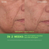 Vita-C Glycolic before and after 2 weeks brighter smoother glow
