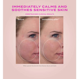 Heartleaf cream cheek before and immediately after calm comparison