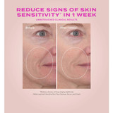 Heartleaf cream before and after 1 week sensitivity signs comparison