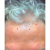 REVIAN Lyte Hair Growth Device