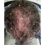 REVIAN Lyte Hair Growth Device