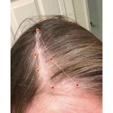 REVIAN Lyte Hair Growth Device