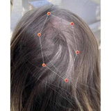 REVIAN Lyte Hair Growth Device