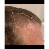 REVIAN Lyte Hair Growth Device