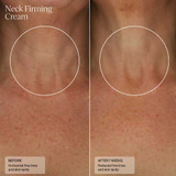 Neck before and after 7 weeks of Sente Neck Firming Cream