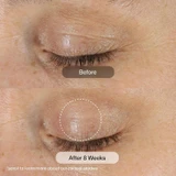 Revision D.E.J. Eye Cream