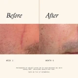 SkinMedica Scar Recovery Gel