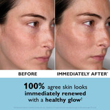 Before and immediately after photos of a woman's cheek